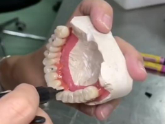 Prothesis lengkap yang tahan lama dengan Titanium Base Keramik Crown Bridge untuk Restorasi Gigi