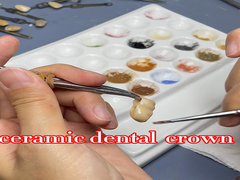 Translucent Natural Looking Zirconia dental crown dengan ketahanan yang sangat baik dan pas yang tepat