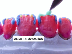 Kekuatan Estetika alami Mahkota Zirconia padat Cocok untuk gigi tunggal atau ganda