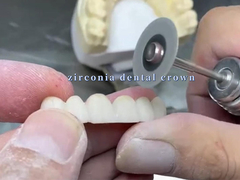 Ketahanan Zirconia Dental Crown untuk Senyum Estetika Pas tepat Biokompatibilitas yang sangat baik