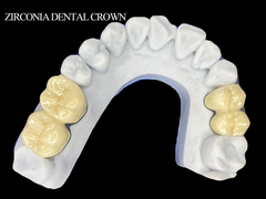 Zirconia Dental Crown untuk molar