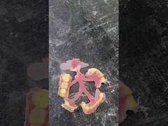 Nesbit Fleksibel Parsial Denture untuk kenyamanan dan daya tahan dalam penggantian gigi