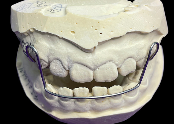 Beli Panduan Alat Arch Orthodontic Retainers Aligners Dengan Retensi Baik Kenyamanan Terbukti online manufacture