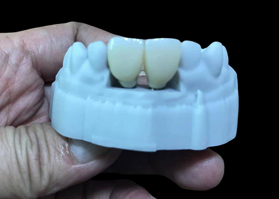 Beli Ganti Dental Implant Kurun Yang Hilang Dengan Titanium Screw Base Dan Zirconia Crown online manufacture