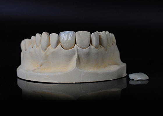 Beli Translucence Porcelain Emax Veneer untuk Fit yang sangat baik / Estetika alami online manufacture