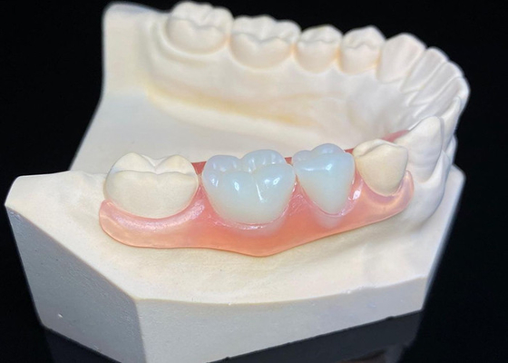 Beli OEM Invisible Removable Dentures Custom Acrylic Resin Prothesis Gigi Parsial online manufacture