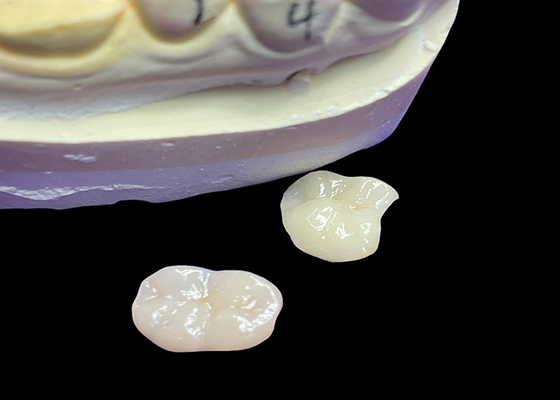 Beli IPS e.max Keramik Inlays dan Onlays untuk Molar Restorasi Aesthetic alami dan daya tahan yang unggul untuk hasil yang tahan lama online manufacture