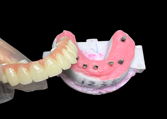 Beli Implan didukung Full Arch Denture Fixed Dental implant Keramik Crown Bridge online manufacture