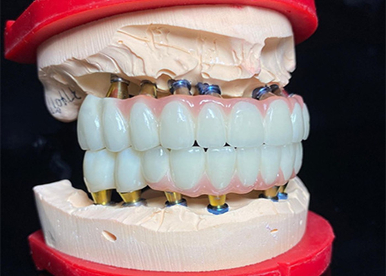 Beli Titanium Base yang dipoles Implan gigi Keramik Crown Bridge Untuk Restorasi Gigi online manufacture