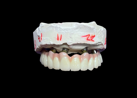 Beli Implantasi Gigi yang Didukung Gigi Lengkungan Lengkap Tetap untuk Solusi permanen, stabil, dan terlihat alami untuk Gigi yang Hilang online manufacture