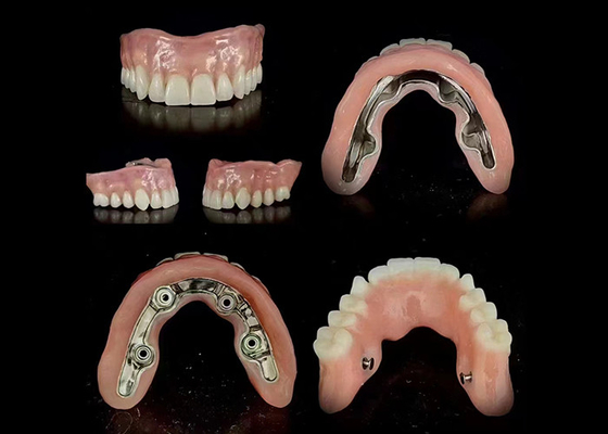 Beli Implantasi precise bar didukung gigi palsu hibrida aman pas stabil disesuaikan online manufacture