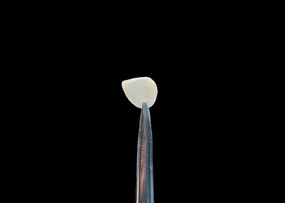 Beli Keakuratan 0.2-0.5mm EMAX Kosmetik veneers gigi terlihat alami Ikatan Kimia online manufacture
