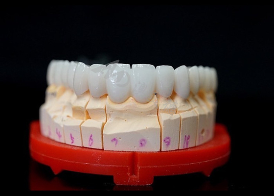 Beli Mahkota Zirconia yang sangat cocok, mahkota Zirconia yang sangat kompatibel untuk gigi online manufacture