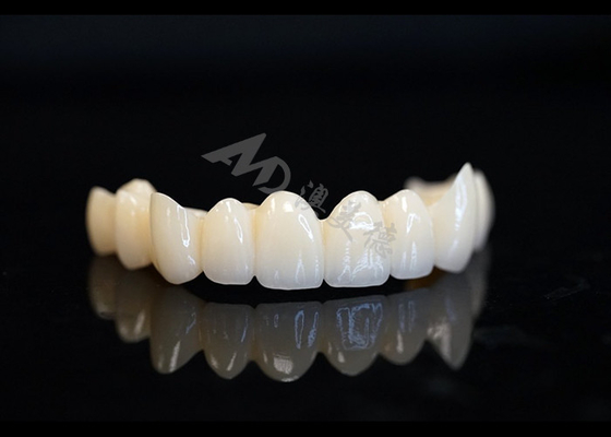 Beli Precision Made Solid Zirconia Crown Untuk Fit Gigi yang Sempurna Dan Kenyamanan online manufacture