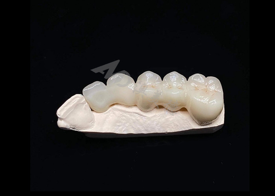 Beli Translucence Natural Esthetics Solid Zirconia Crown Untuk Gigi Tahan Celah online manufacture