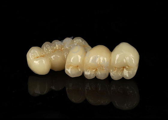 Beli Koruna Zirconia Padat yang Tahan Tembaga Menggabungkan Kompatibilitas Biologi yang Luar Biasa online manufacture