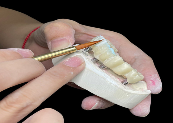 Beli Implan Gigi Polished yang Bisa Disesuaikan Jembatan Mahkota Panjang Umur untuk Kebersihan Mudah online manufacture