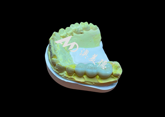 Beli Permukaan halus yang disesuaikan Zirconia Dental Crown Biokompatibilitas tinggi Resistensi noda online manufacture