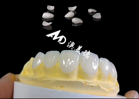 Beli Translucency IPS Emax Veneers, Persiapan Minimal Emax Dental Veneers online manufacture