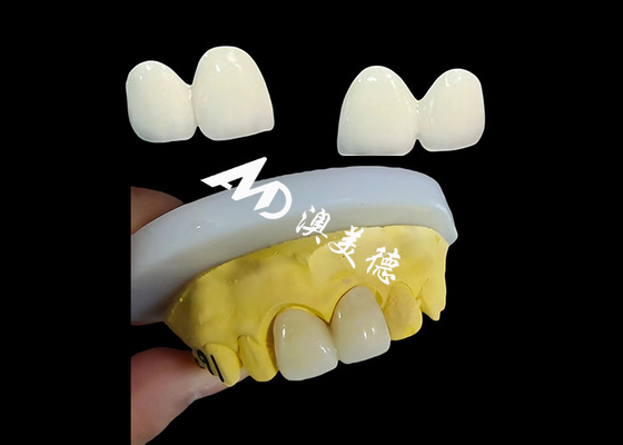 Beli Custom Zirconia Dental Crown Precise Fit Tooth Cap dari laboratorium gigi Cina online manufacture