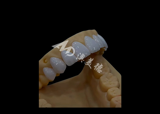 Beli Prosthetic Dentistry Zirconia Dental Crown Precise Fit Estetika Untuk Gigi Lengkung Lengkap online manufacture