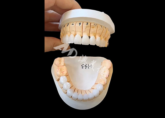 Beli Tumbuh Translucence Zirconia Dental Crown Untuk Single / Multi Unit Fixed Restorasi online manufacture