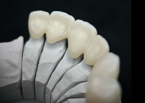 Beli Dental Solid Zirconia Crown Ombining Kekuatan Luar Biasa Dan Estetika Alami online manufacture