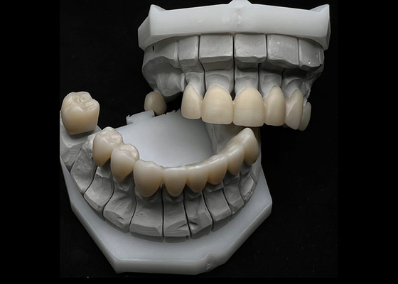 Beli Ketahanan Celah Dental Zirconia Crown Untuk Gigi Tunggal atau Berganda online manufacture