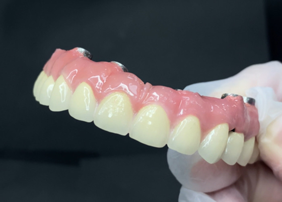 Beli Implan gigi tahan lama dengan abutment titanium yang mudah dibersihkan dan mahkota zirconia online manufacture