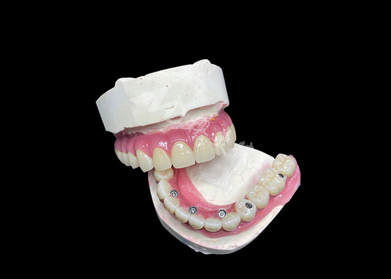Beli Zirconia Dental Implant Crown Bridge semua di lantai 6 untuk penggantian gigi yang hilang online manufacture