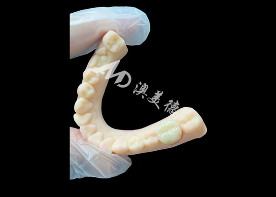 Beli Kekuatan Tinggi Keramik Zirconia Posterior Dental Crown Superior Estetika dan Ketahanan online manufacture