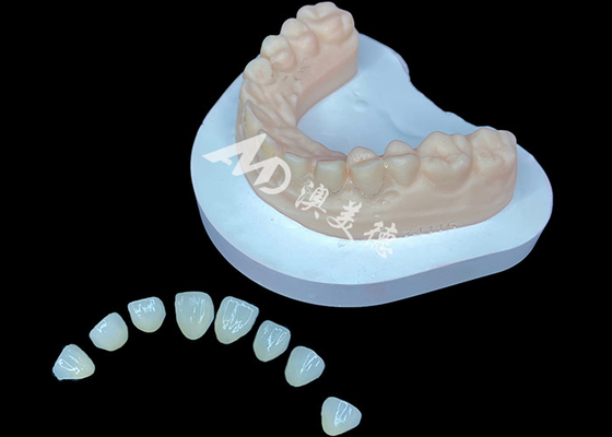 Beli IPS e.max Veneer Premium Solusi Estetika untuk Transformasi Senyum Menakjubkan online manufacture