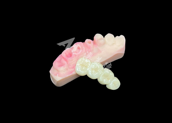 Beli Superior Solid Zirconia Crown bridge untuk estetika gigi yang terlihat alami online manufacture