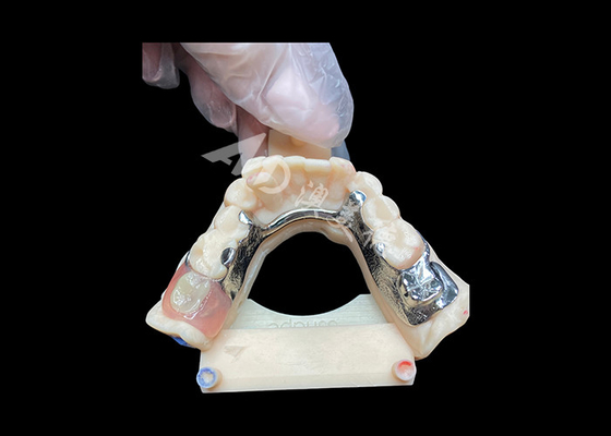 Beli Perbaikan yang Mudah Dental Parsial Cast untuk Kekuatan dan Daya Tarik Estetika yang Lebih Tinggi online manufacture