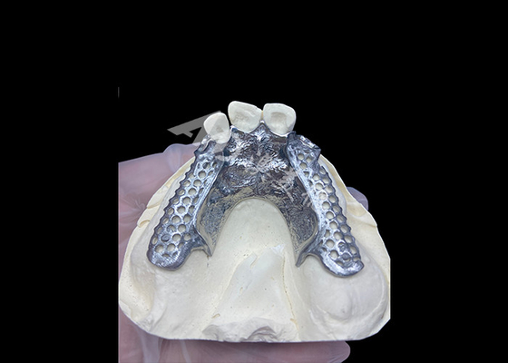 Beli Easy Fit Custom Cast Partial Denture Frame yang stabil dan terlihat alami untuk hasil yang cepat online manufacture