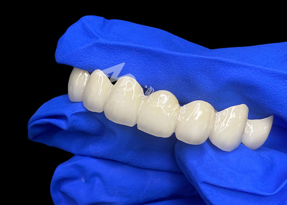 Beli High Translucency Lava Zirconia Dental Bridge Campuran Tanpa Jait Dengan Gigi Alami online manufacture