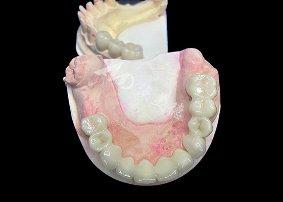 Beli Natural Looking Lava Zirconia Crown Dengan Daya Tahan yang Tak Terbandingkan Biokompatibilitas yang Luar Biasa online manufacture