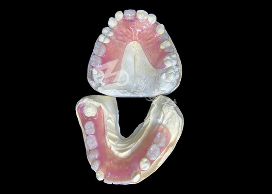 Beli Valplast Fleksibel Parsial Denture Untuk kenyamanan maksimal Dan daya tarik estetika online manufacture