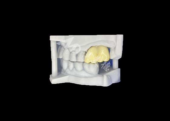 Beli Tulang gigi solid Zirconia Mahkota tahan lama Durability Dijamin Molar Dari China Dental Lab online manufacture