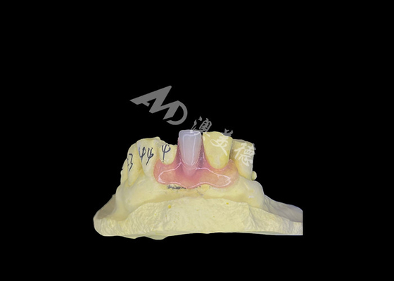 Beli Nesbit Fleksibel Parsial Denture untuk kenyamanan dan daya tahan dalam penggantian gigi online manufacture
