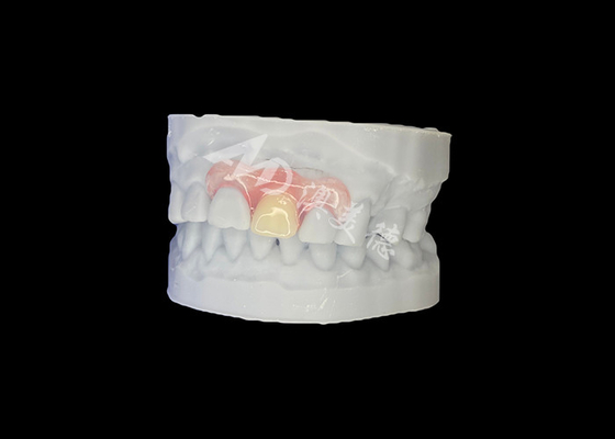 Beli Dental parsial fleksibel Nesbit yang disesuaikan untuk kecocokan alami dan kenyamanan jangka panjang online manufacture