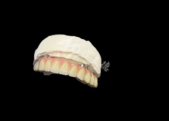 Beli Dentitas yang Didukung Implantasi Stabilitas Kenyamanan dan Senyum Alami online manufacture