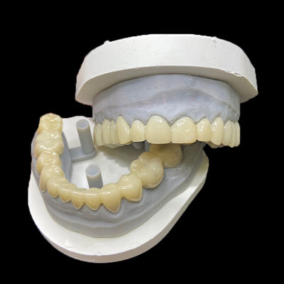 Beli PMMA Temporary Restorations CAD/CAM PMMA Crowns and Bridges for Provisional Dental Cases online manufacture