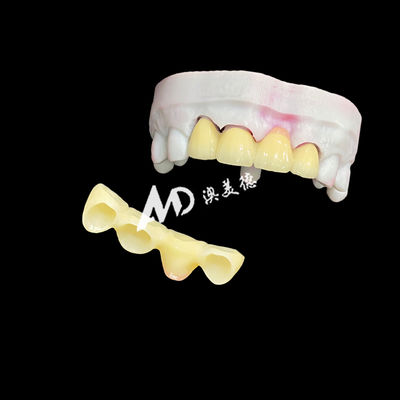 Beli Premium Ceramic Crowns and Bridges for High-Strength, Natural Aesthetics and Long-Lasting Clinical Performance online manufacture