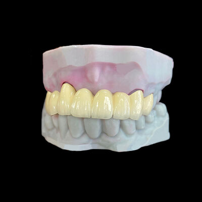 Beli Porselen Ditemukan pada Logam (PFM) Mahkota dengan Kerangka Co-Cr online manufacture