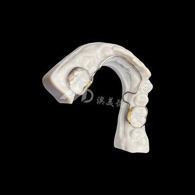 Beli Lengkungan Lingual Khusus dengan Alat Ortodontik Pita untuk Pemeliharaan Ruang dan Penyelarasan Gigi online manufacture