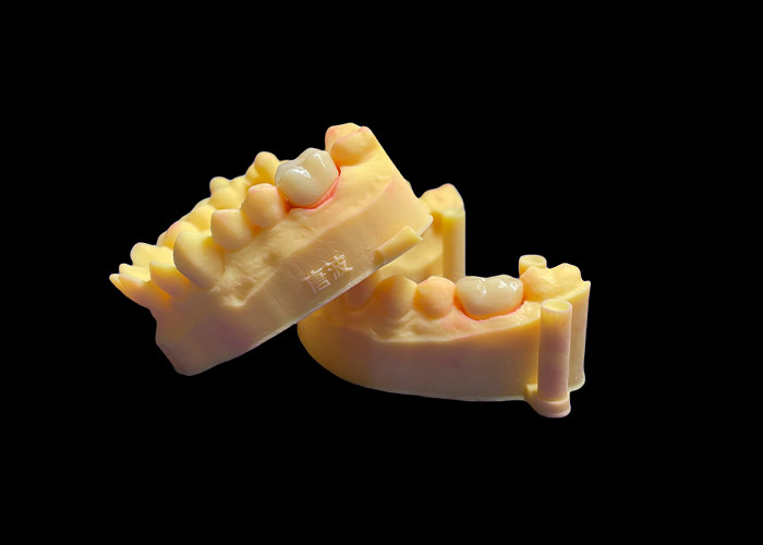 Premium Zirconia Porselen Dental Crown Kekuatan tak tertandingi Precision Fit dan Eksklusif Estetika dan Ketahanan