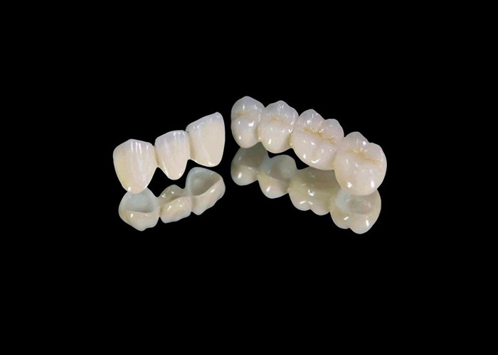 Pakaian tahan Zirconia Dental Crown dengan chip dan tahan noda dan estetika alami dari laboratorium gigi Cina