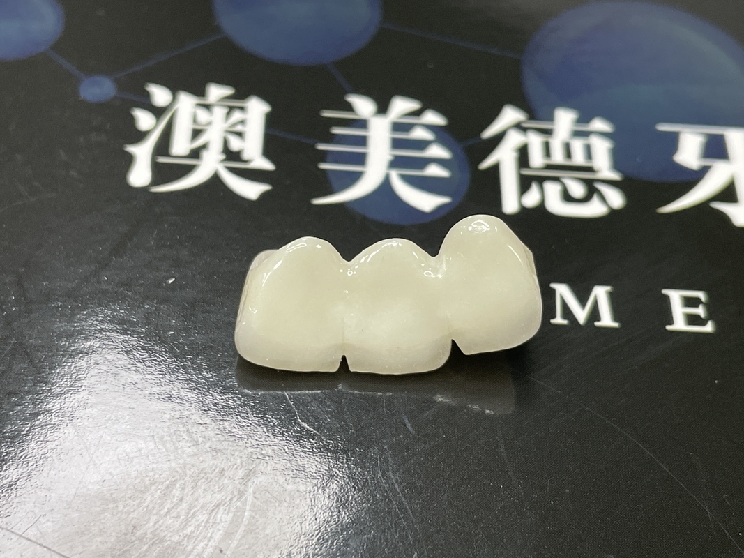 Natural Aesthetics Mahkota Keramik Translucent untuk Restorasi Gigi dengan Pembersihan Mudah dan Hasil yang Lama