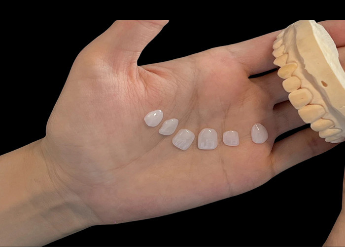 Porselen Shade Ultra Thin EMAX Veneers tahan noda untuk restorasi estetika
